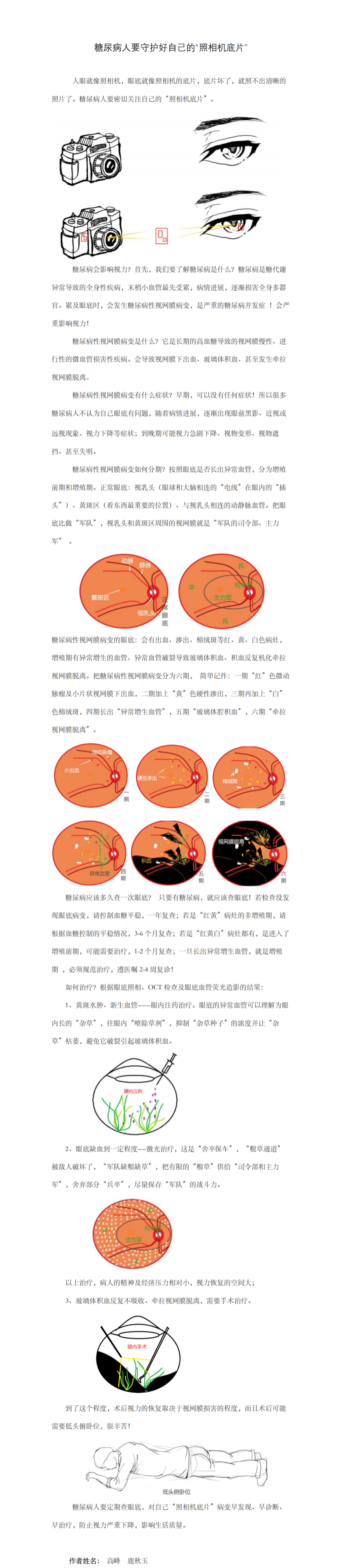 糖尿病人要守护好自己的“照相机底片”(1187)_03_副本.png